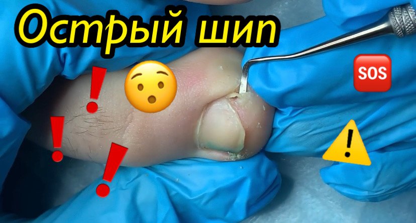 Острый шип?⚠️?❗️ смотреть онлайн