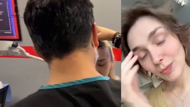 Результат пересадки волос у женщин, пересадка волос для коррекции лба и линии роста волос смотреть онлайн