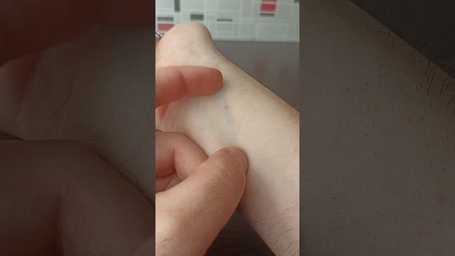Как избавиться от укуса цикады. Последствия укуса смотреть онлайн