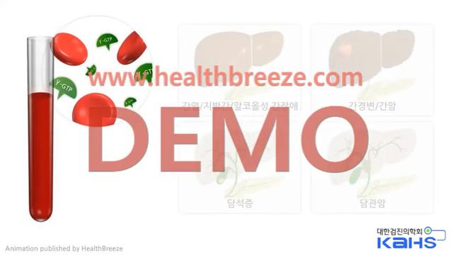 [시연용] b0233aako_[대한검진의학회] 간기능검사(AST/ALT/r-GTP 이상) 결과 안내 (건보검진 유소견 설명) смотреть онлайн