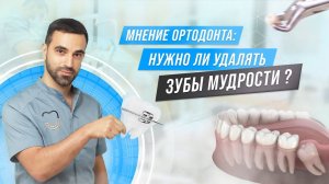 Нужно ли  УДАЛЯТЬ ЗУБЫ МУДРОСТИ перед ИСПРАВЛЕНИЕМ ПРИКУСА?