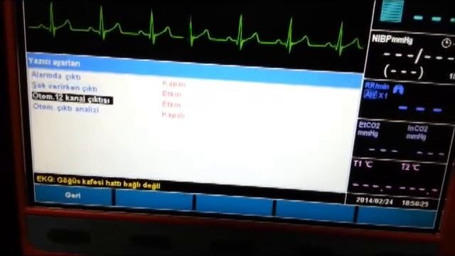 EGELANS EMS IZMIR PRIMEDIC EVO DEFI TANITIM 2 смотреть онлайн