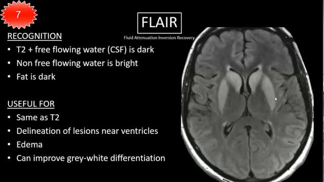 MRI t1 vs t2 смотреть онлайн
