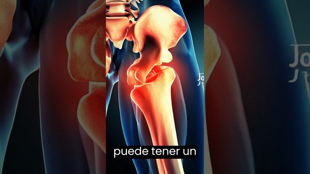 ¿Conoces la artritis?, Todo lo que necesitas saber tipos, síntomas y tratamientos. смотреть онлайн