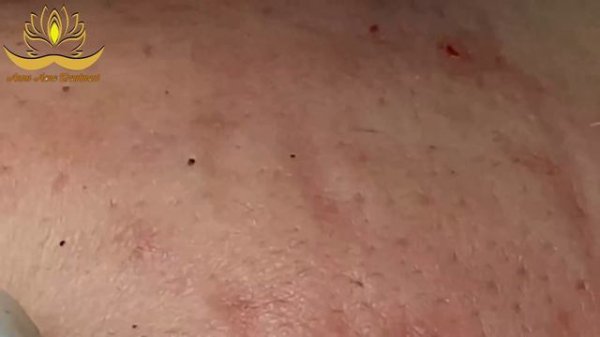 Most Satisfying and Relaxation with An Spa Video #135