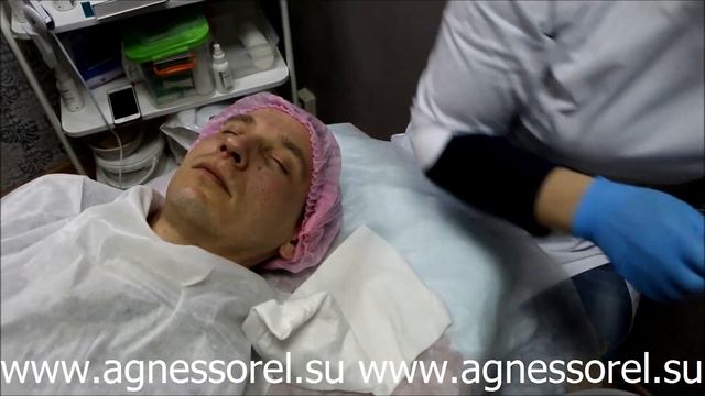 Agnessorel.Su - косметологический комбайн для лица Micros 6D,7D смотреть онлайн