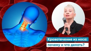Кровотечение из носа: почему и что делать?