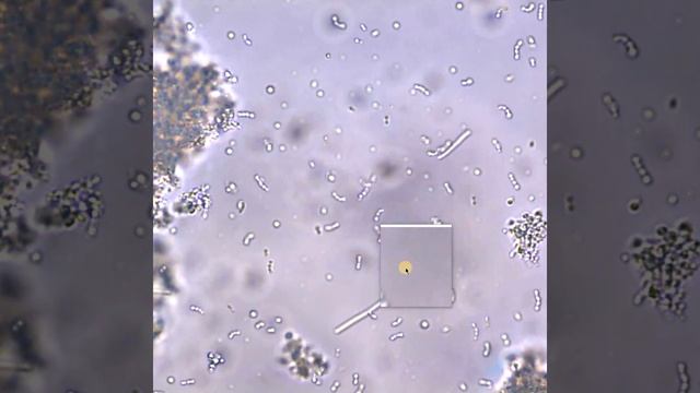 Bulgarian yogurt under a light microscope by Sofia Pathology - part 2 - microbiome, probiotics смотреть онлайн