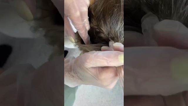 Газожиткостный пилинг кожи головы смотреть онлайн