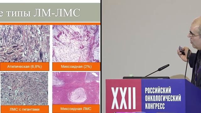 Мезенхимальные опухоли тела матки, дифференциальная диагностика, прогноз смотреть онлайн