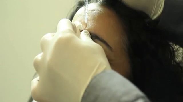 Инъекции Ботокса в эстетической медицине для удаления морщин