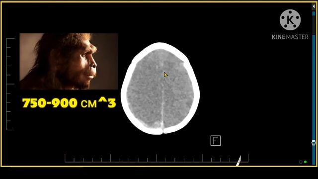 Чей мозг весит больше? смотреть онлайн