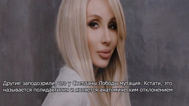 У показавшей шесть пальцев на ноге Лободы заподозрили мутацию смотреть онлайн
