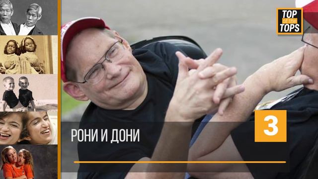 ТОП 5 на най-интересните истории за сиамски близнаци смотреть онлайн