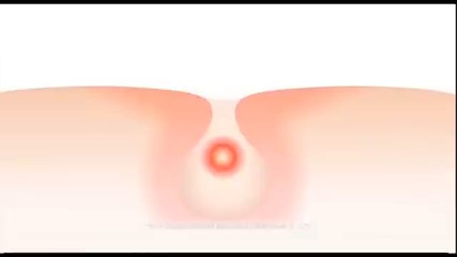 Neutrogena Acne Stress Control 2010 Ad смотреть онлайн