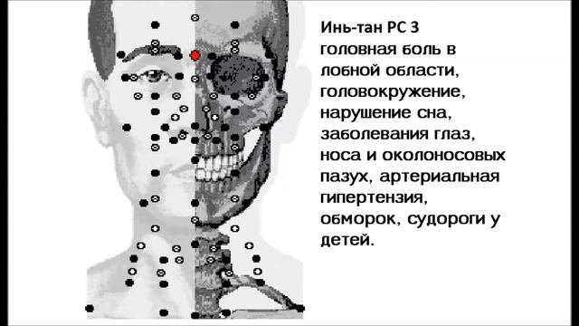 Акупунктурные точки от эпилепсии смотреть онлайн