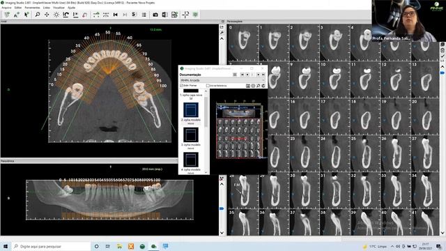Geração de Template e Documentação no Imaging Studio - Webinar Anne Solutions смотреть онлайн