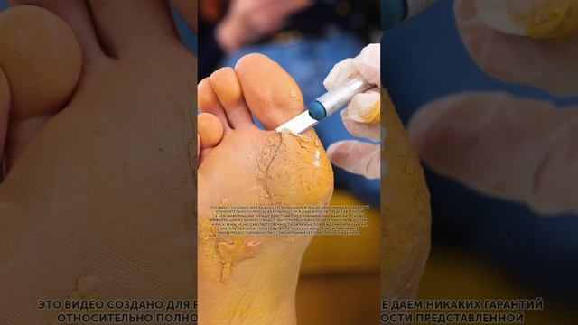 ИДЕАЛЬНЫЕ ЛАЙФХАКИ ДЛЯ НОГ, МАНИКЮРА И ОБУВИ