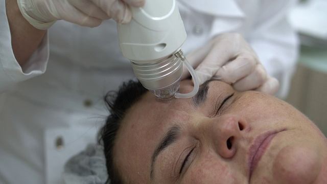 Микроигольчатый RF-лифтинг Inus.mp4 смотреть онлайн