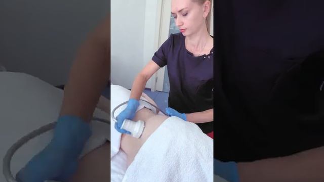 Аппаратная процедура в клинике Sun De Vie, Самара. Врач-косметолог Шлепикова Елена Викторовна