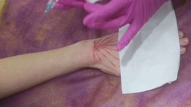 РУКИ комбитехника:канюля +игла / бустер+ PDRN смотреть онлайн