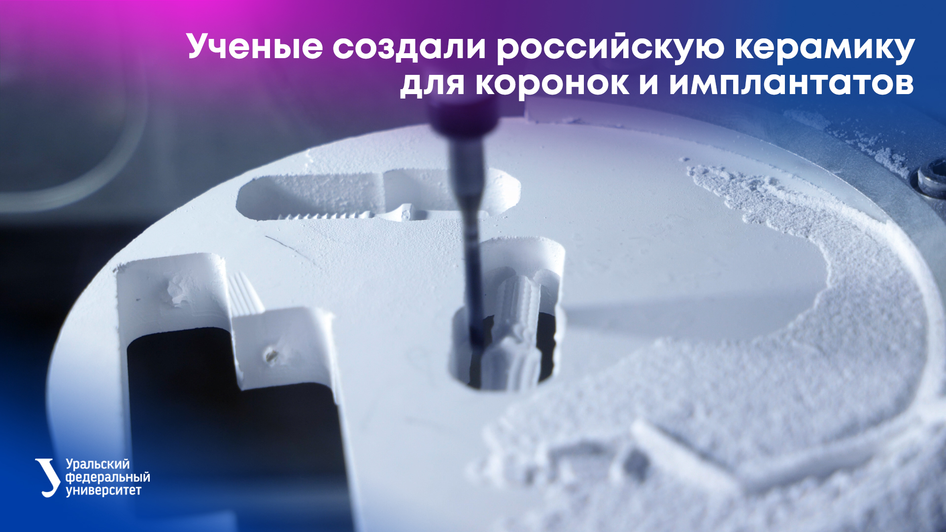 Ученые создали российскую керамику для коронок и имплантатов смотреть онлайн