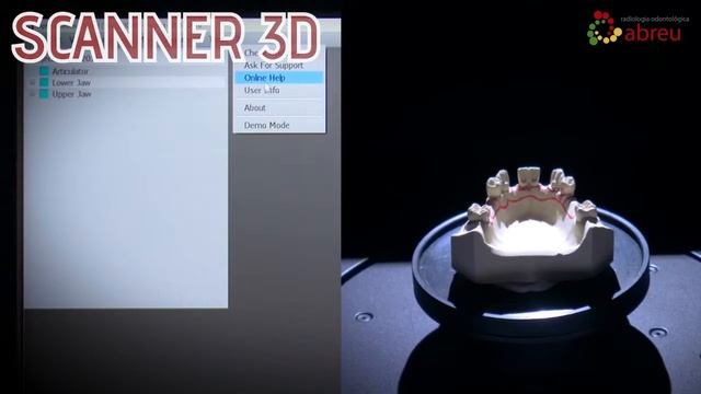 Scanner Para o seu Modelo de Gesso! смотреть онлайн
