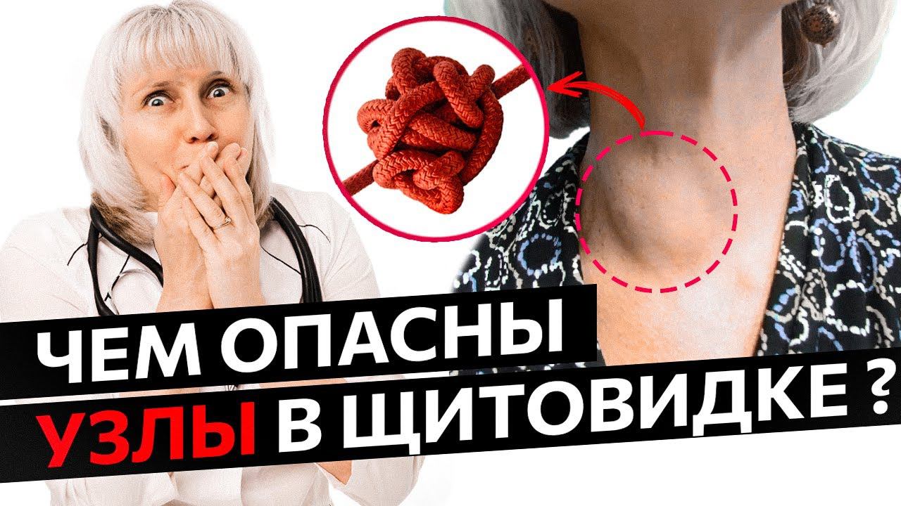 Чем опасны узлы в щитовидке. Доктор Лисенкова смотреть онлайн