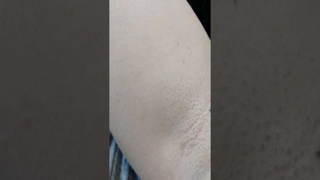 Состояние кожи и волос через 2 недели... После ЭЛОС эпиляции... Светлана Яковенко Оренбург смотреть онлайн