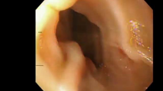 Endoscopy Done ✅ смотреть онлайн