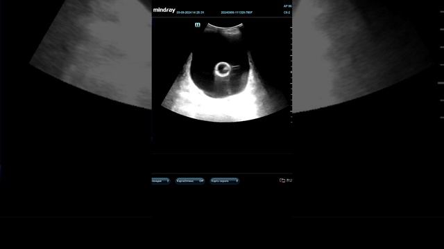 Хирургия&УЗИ