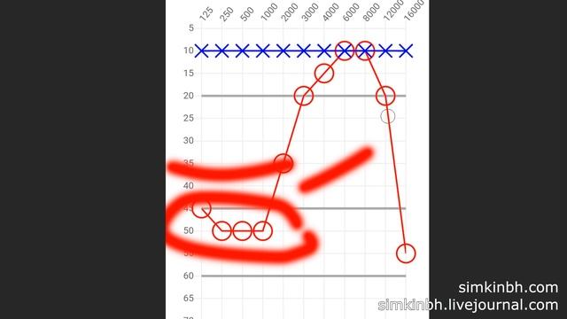 Зимняя акция про слух 2020-2021 часть №2 (5-8). Исправления слуха смотреть онлайн