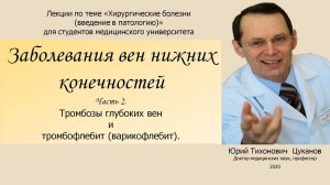 Болезни вен, часть 2  Венозные тромбозы, тромбофлебиты. Лекция для студентов медуниверситета.