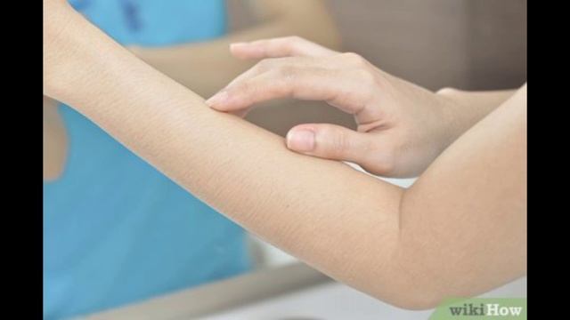 Boro plus cream review// Boro plus antiseptic cream benefits// best mosturiser for dry skin// смотреть онлайн