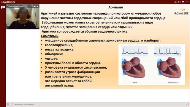 Вебинар 10 декабря 2019. Дела сердечные смотреть онлайн