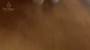 Professional bleckheads   Выдавливание черных точек прыщей   самое залипательное видео 2023