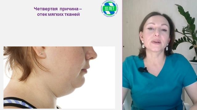 Как убрать второй подбородок?  Тейпирование второй подбородок