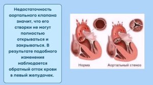 Почему человек покачивает головой?  Симптом Мюссе,  покачивание головы