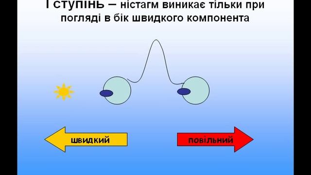 The degrees of nystagmus смотреть онлайн