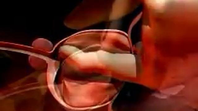 adenomectomie voie haute смотреть онлайн