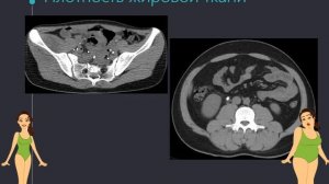 Правила чтения компьютерных томограмм 3