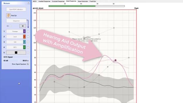 How To Perform Real Ear Measurement (REM) | Using Natus Aurical PMM смотреть онлайн