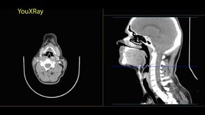 Базовая КТ анатомия шеи