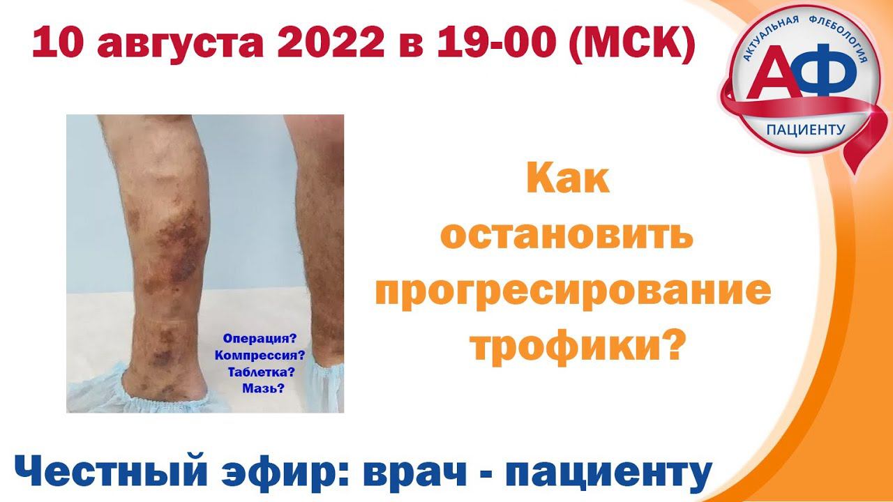 Как остановить прогрессирование трофики при заболеваниях вен? смотреть онлайн