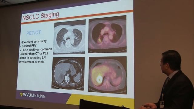Mini Med School | Lung Cancer смотреть онлайн