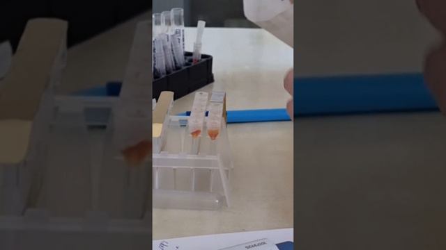 Аутоиммунная проба, прямая проба Кумбса, проба на совместимость, аутоиммунная холодовая проба и ещё смотреть онлайн