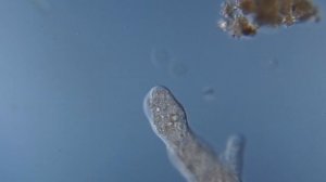 Движение амебы под микроскопом