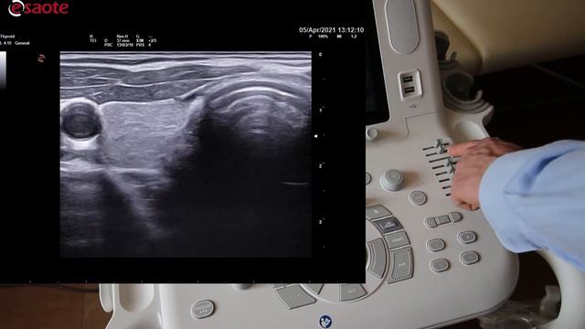 Jak poprawić obrazowanie B-Mode w aparacie USG w 7 krokach. смотреть онлайн