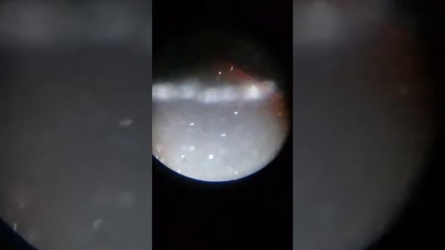Смотрим пробник под микроскопам лёгкая платья и перо смотреть онлайн