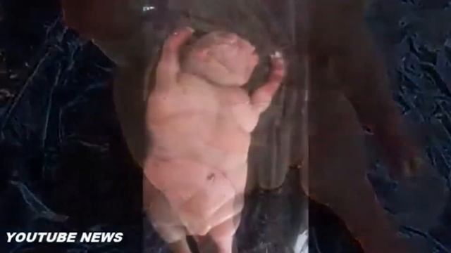 Ужас! Родился человек мутант! Слабонервным не смотреть. Настоящая жесть.